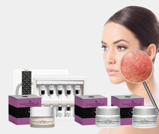 Red stop rosacea (rósroða meðferð)