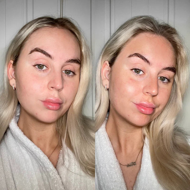 Wonder Water Watermelon - Light / Medium